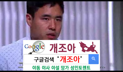 포경수술에 대해 어떻게 생각해? 이미지 #2